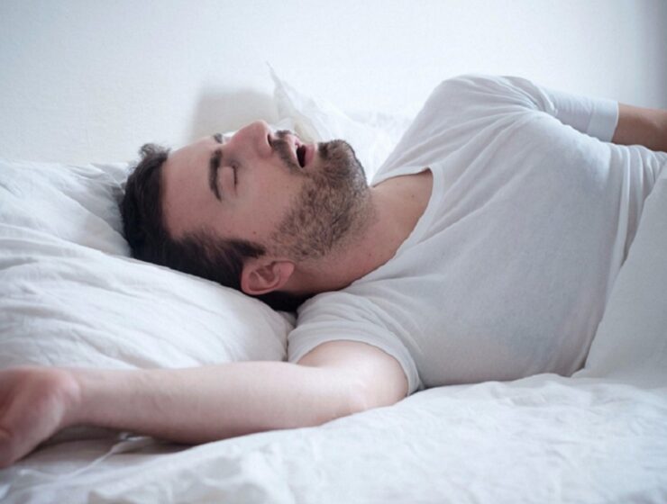 1 in 2 men in Greece diagnosed with sleep apnea