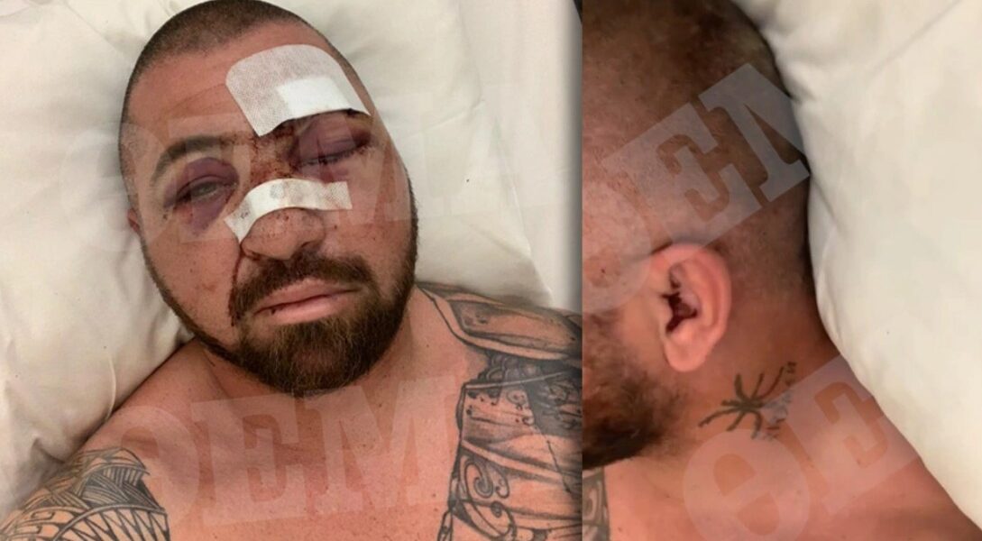 Dan Bilzerian's bodyguard beaten by French-Moroccans: "I'm lucky to live, I was stoned with large rocks" 1