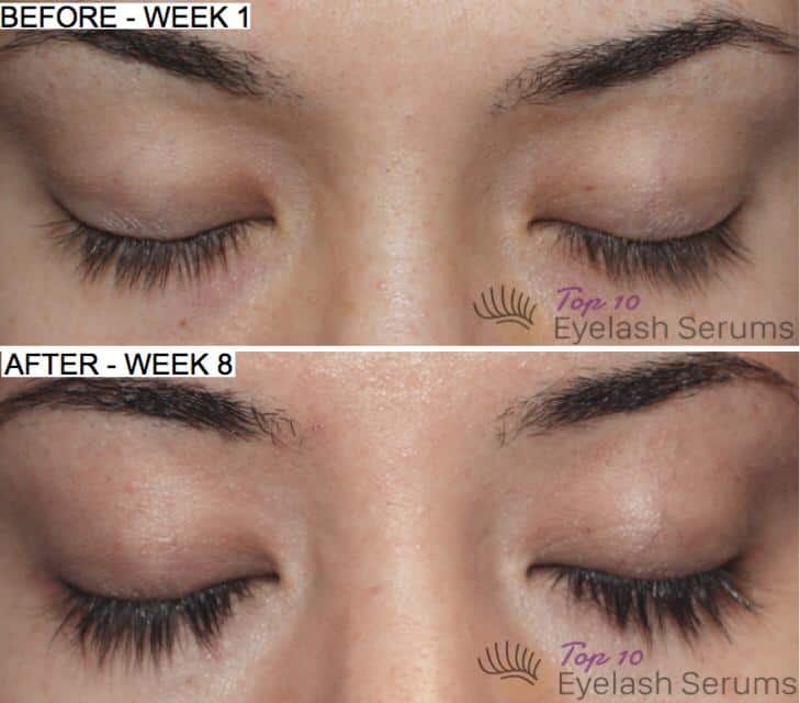top 10 eyelash serums before after results