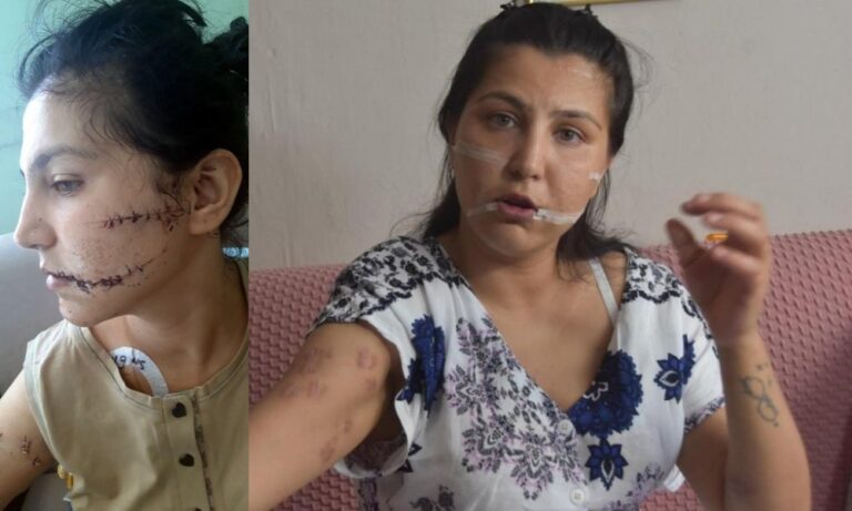 DOMESTIC VIOLENCE: Turkish man stabs his wife 104 times in front of their child