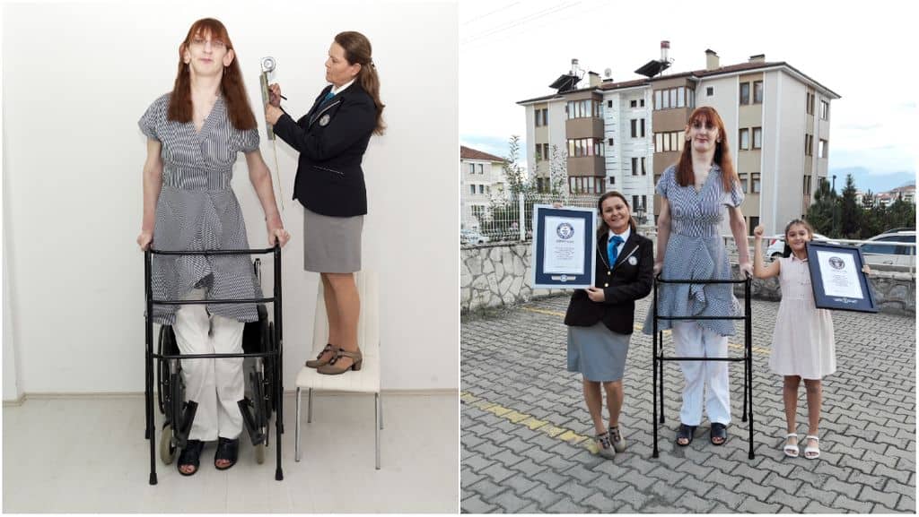 2021 Records: la mujer más alta del mundo descubierta en Turquía (video) 4