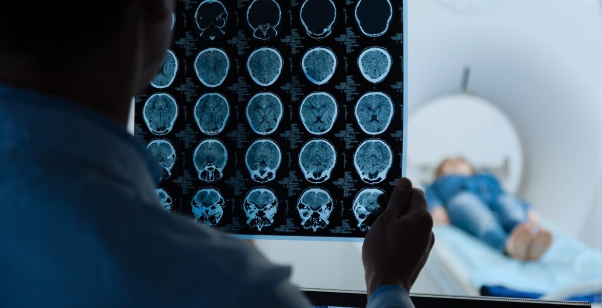 brain scan brain tumour