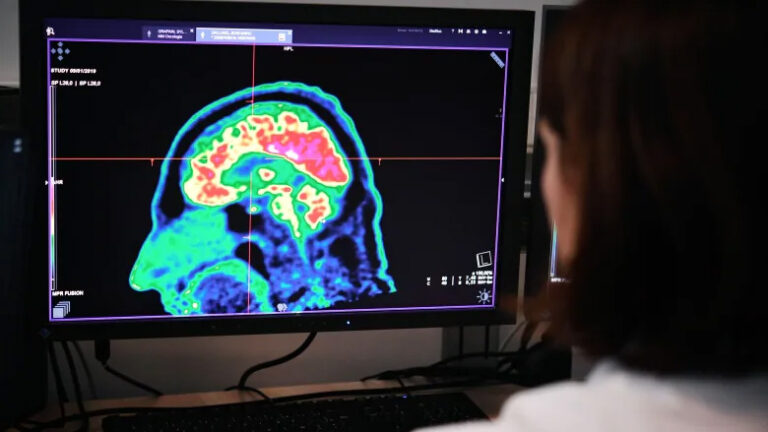 MEDICAL BREAKTHROUGH: New drug beats Alzheimers for first time