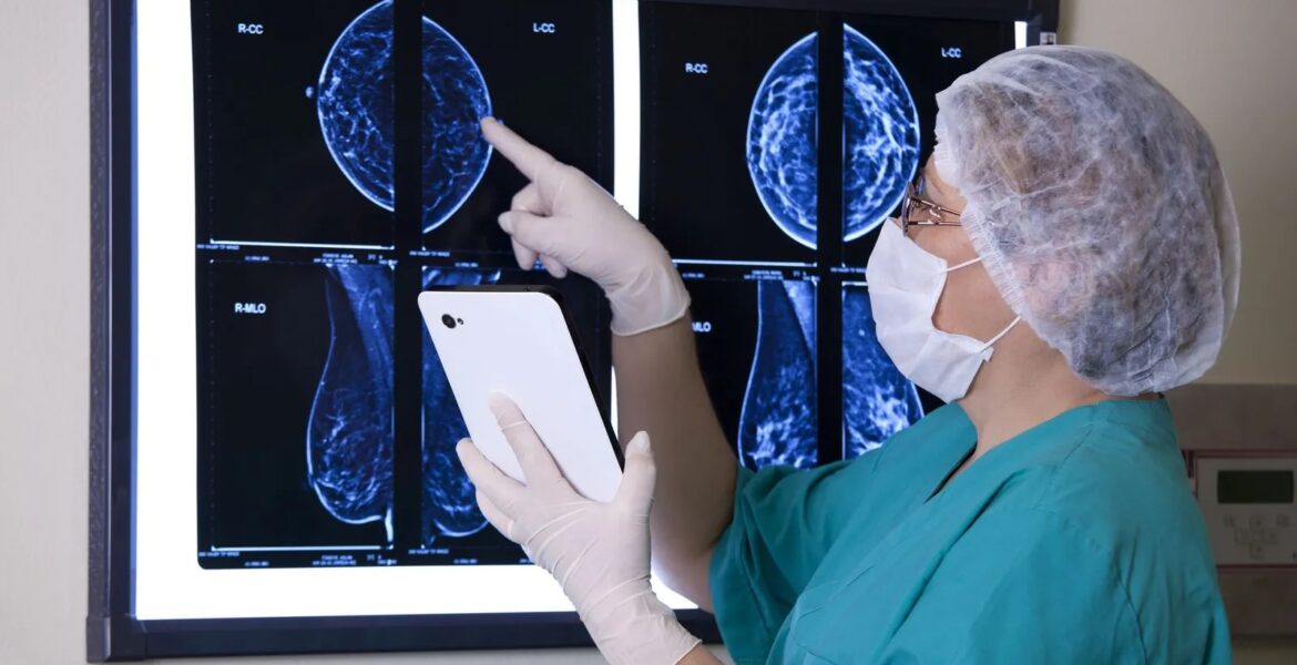 breast cancer mammography