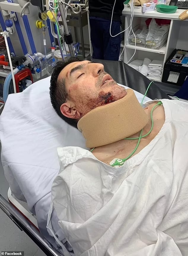 72318567 12225339 Mr Totsis above in hospital was allegedly punched by Din Decevic a 100 16874943019 jpg