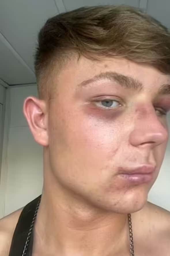 Horrific injuries suffered by British teen in Greek nightclub attack shown