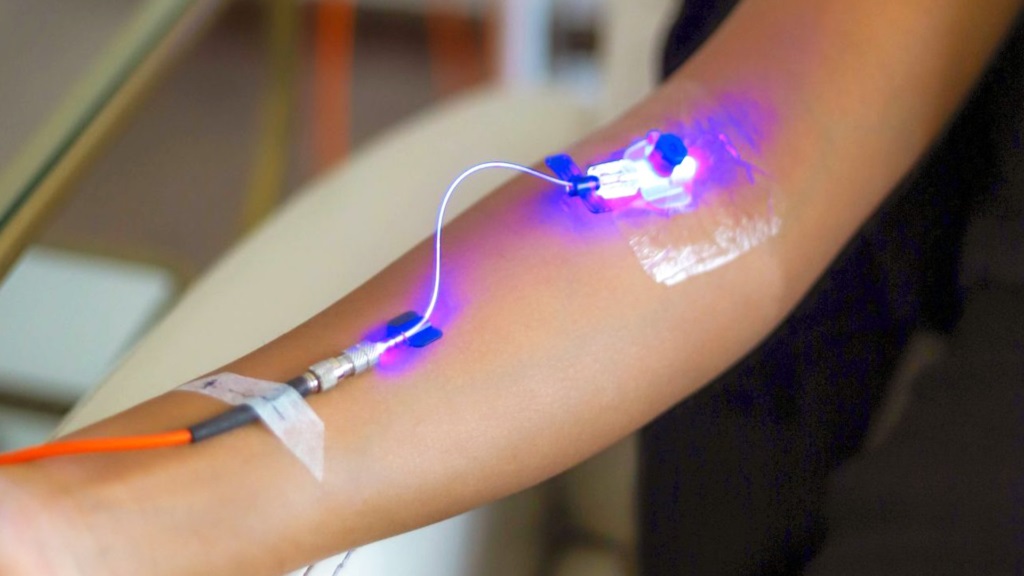 Intravenous laser therapy