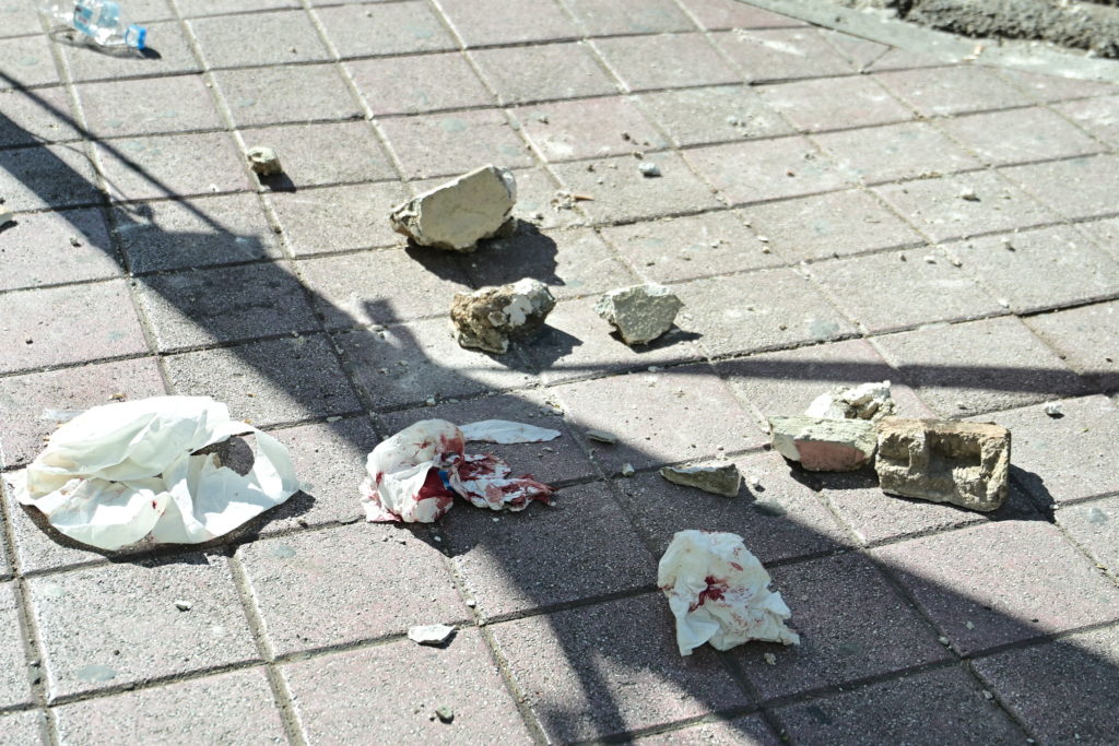 A 14-year-old girl was seriously injured and underwent surgery for an epidural hematoma after a section of a balcony fell on her head in Saint Anargyroi. She was conscious and speaking despite the injury and was quickly transported to the Children's Hospital for surgery.